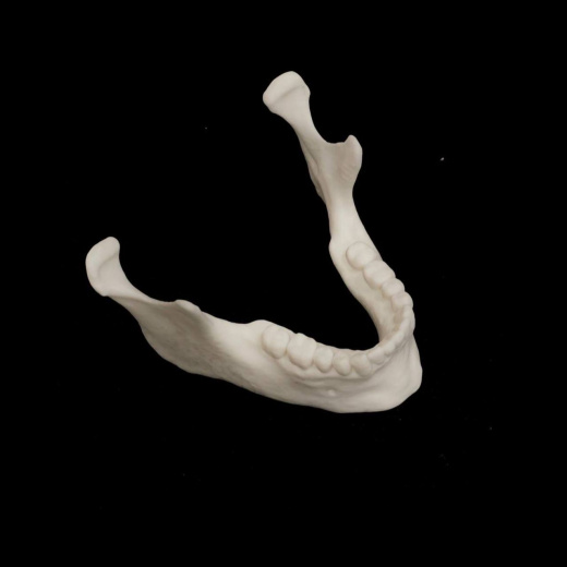 Нижняя челюсть (Mandibula)