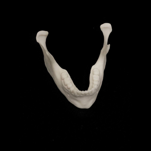 Нижняя челюсть (Mandibula)