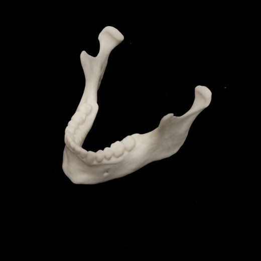 Нижняя челюсть (Mandibula)